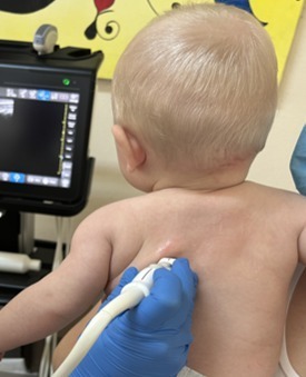 Rolul inteligenței artificiale în ecografia pulmonară pediatrică, explicat de un medic din Timișoara